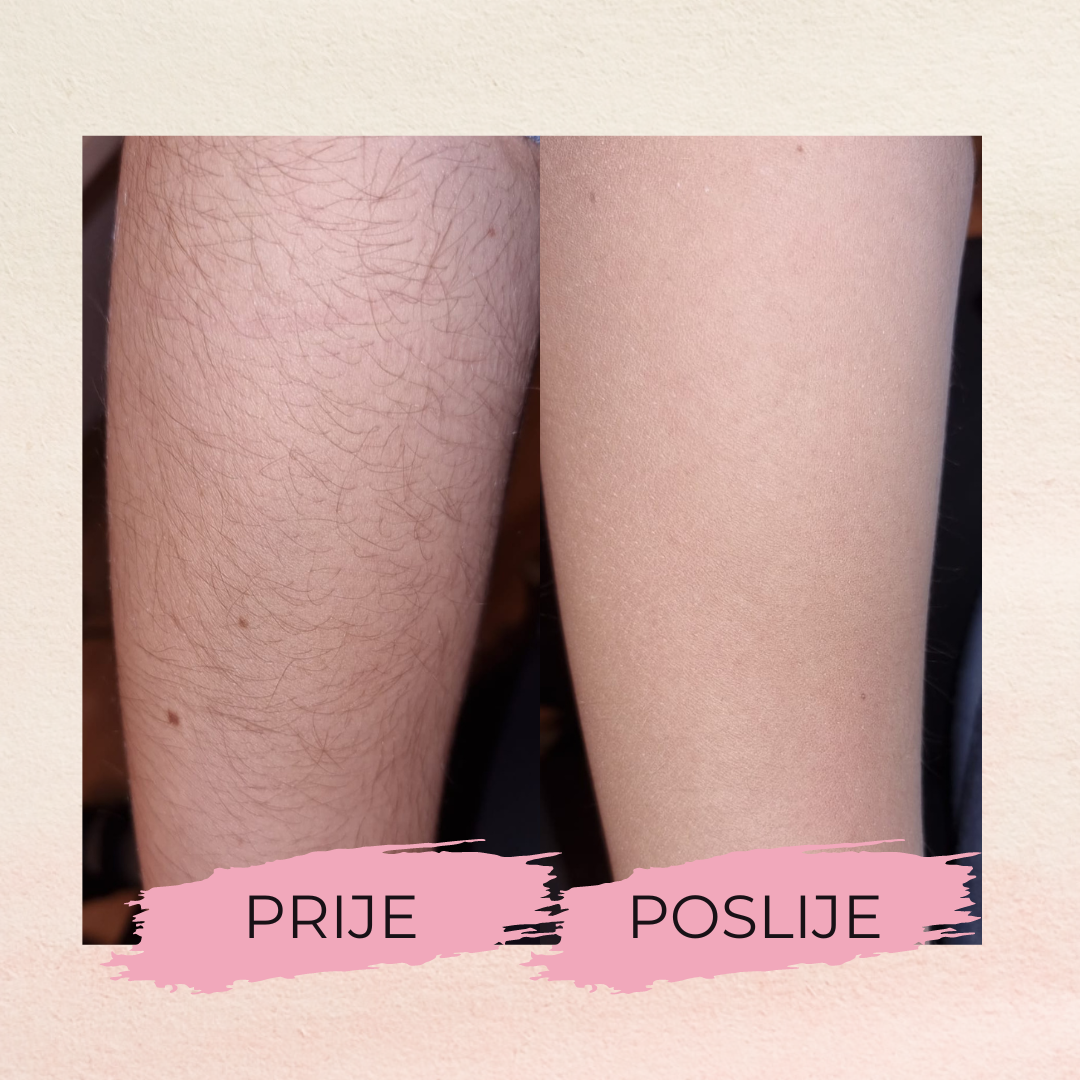 Dlakobrisač - Crystal Hair Remover